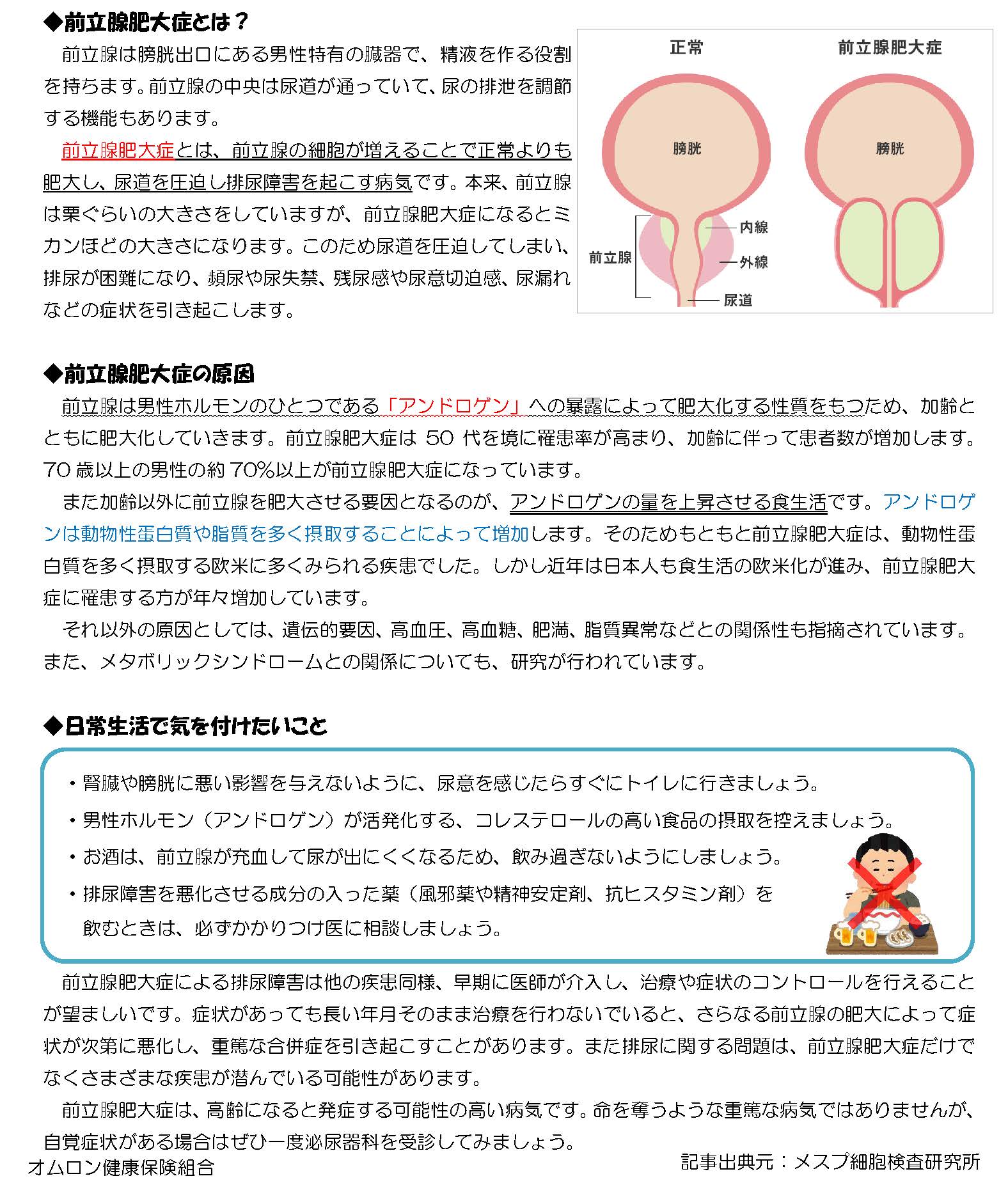 前立腺肥大症とは