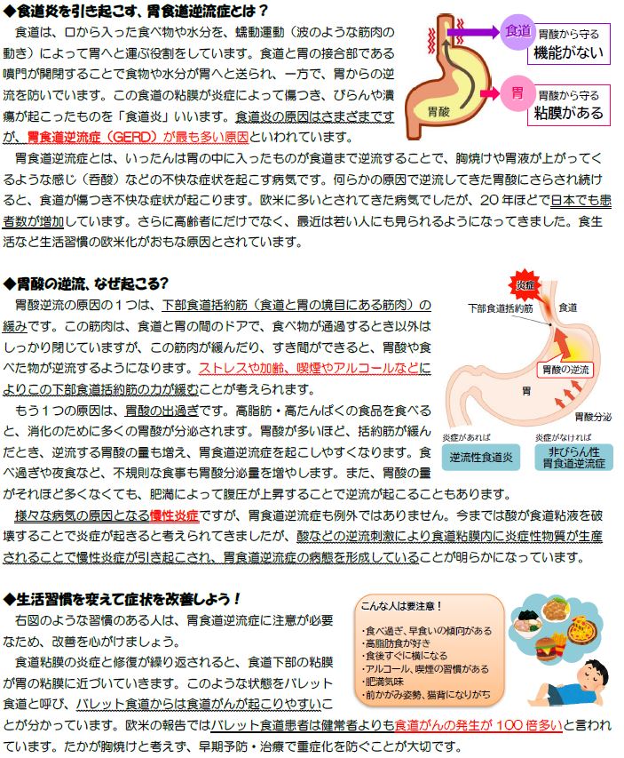 胃食道逆流症