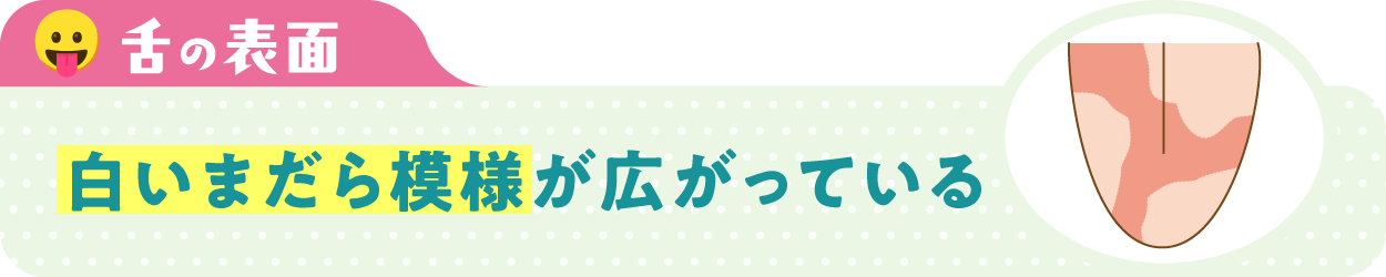 舌の表面