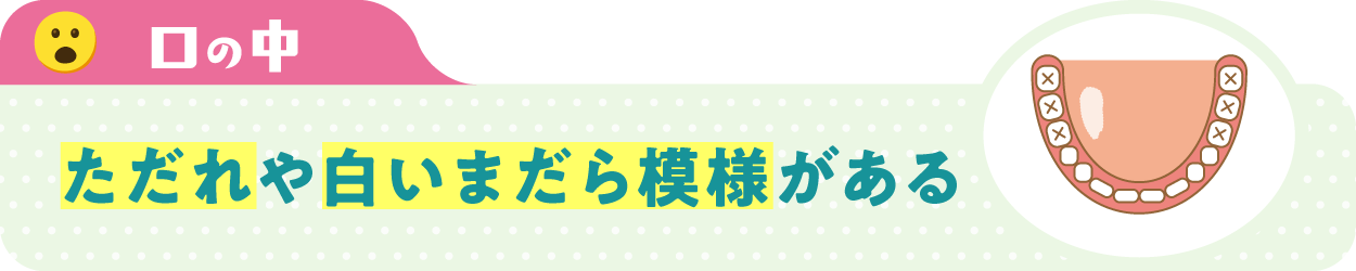 口の中